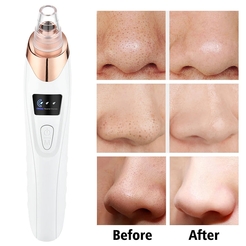 Electric Vacuum Suction for Facial Cleaner