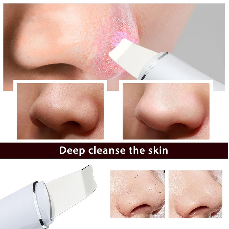 Facial Cleaner Device