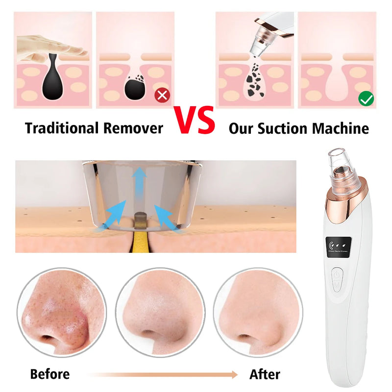 Electric Vacuum Suction for Facial Cleaner